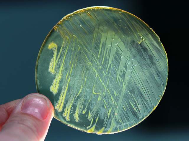 колонии золотой бактерии